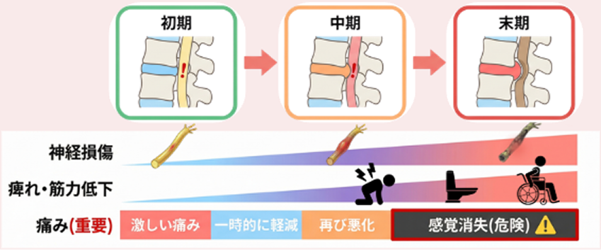 神経損傷の進行度（初期・中期・末期）と症状の変化