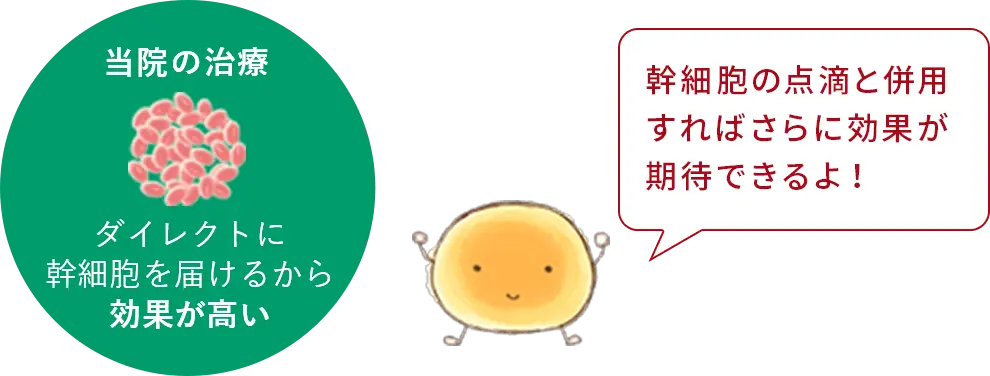 当院の治療：ダイレクトに幹細胞を届けるから効果が高い
