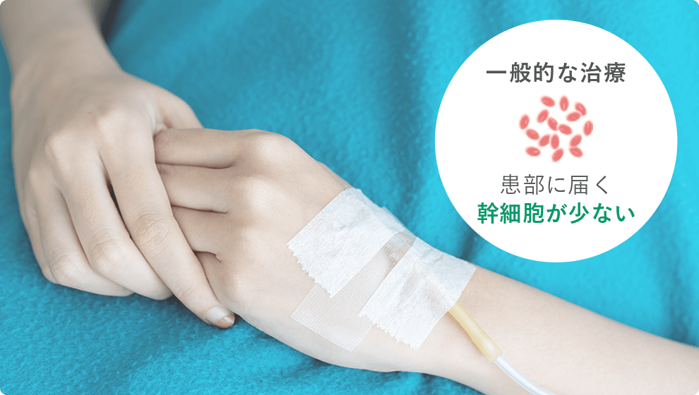 一般的な治療：患部に届く幹細胞が少ない
