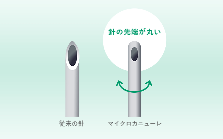 マイクロカニューレ:針の先端が丸い