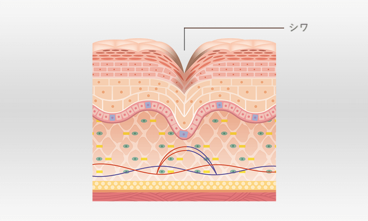 再びシワが出現したお肌