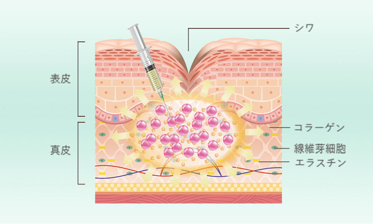コラーゲンやエラスチンなどの美肌成分が現象しシワができる
