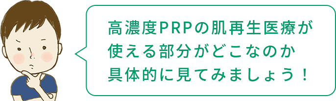 肌再生医療で高濃度PRPの使える部分がどこなのか具体的に見る