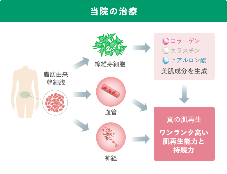 当院の治療:ワンランク高い肌再生能力と持続力