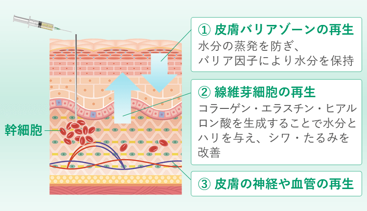 img truth02 sp