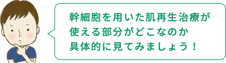 幹細胞を用いた肌再生治療が使える部分がどこなのか具体的に見てみましょう!