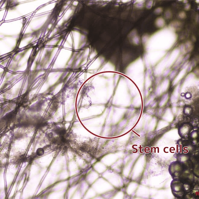 幹細胞を抽出