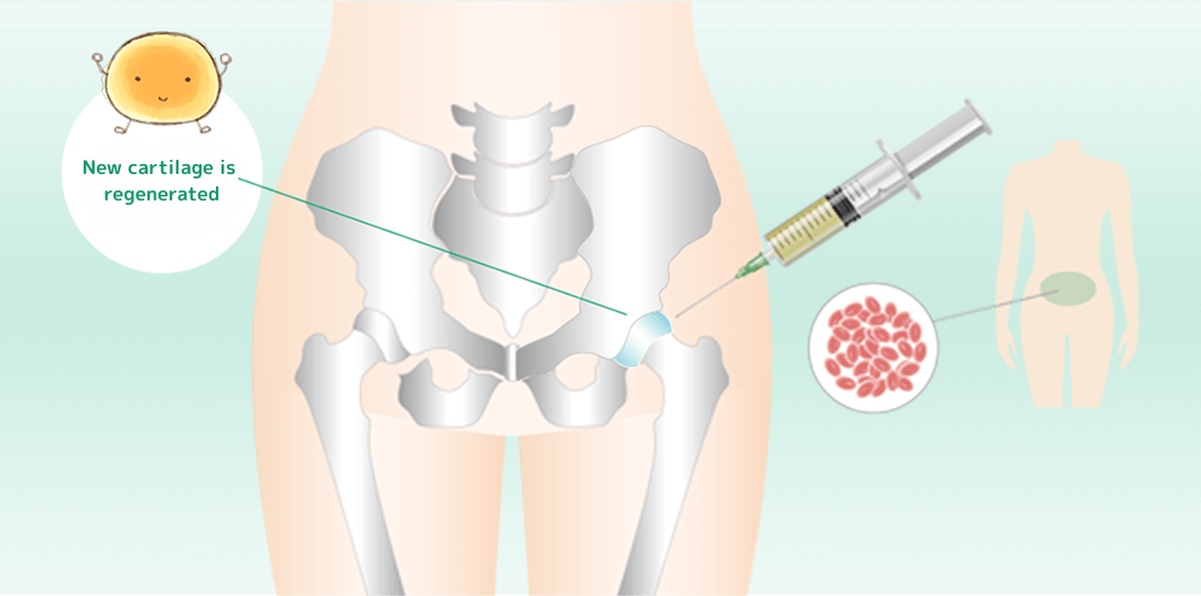 幹細胞治療（再生医療）