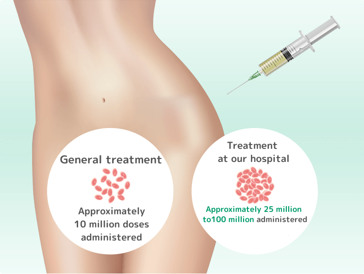 股関節の再生医療、一般的には約1,000万個投与、当院の幹細胞治療なら約2,500万個～1億個も投与可