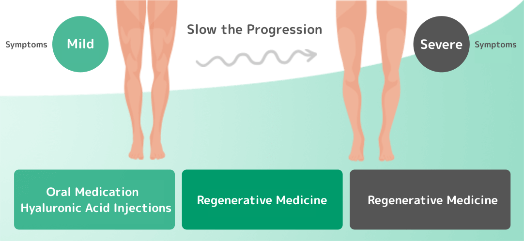 股関節の変形、進行を遅らせる