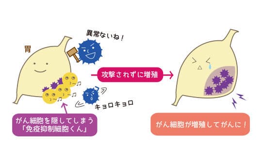イラスト：胃の中の免疫抑制細胞が攻撃されずにがん細胞が増殖