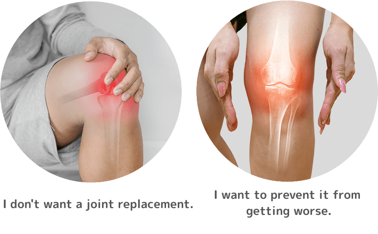 膝を人工関節にしたくないが、重症化は予防したい