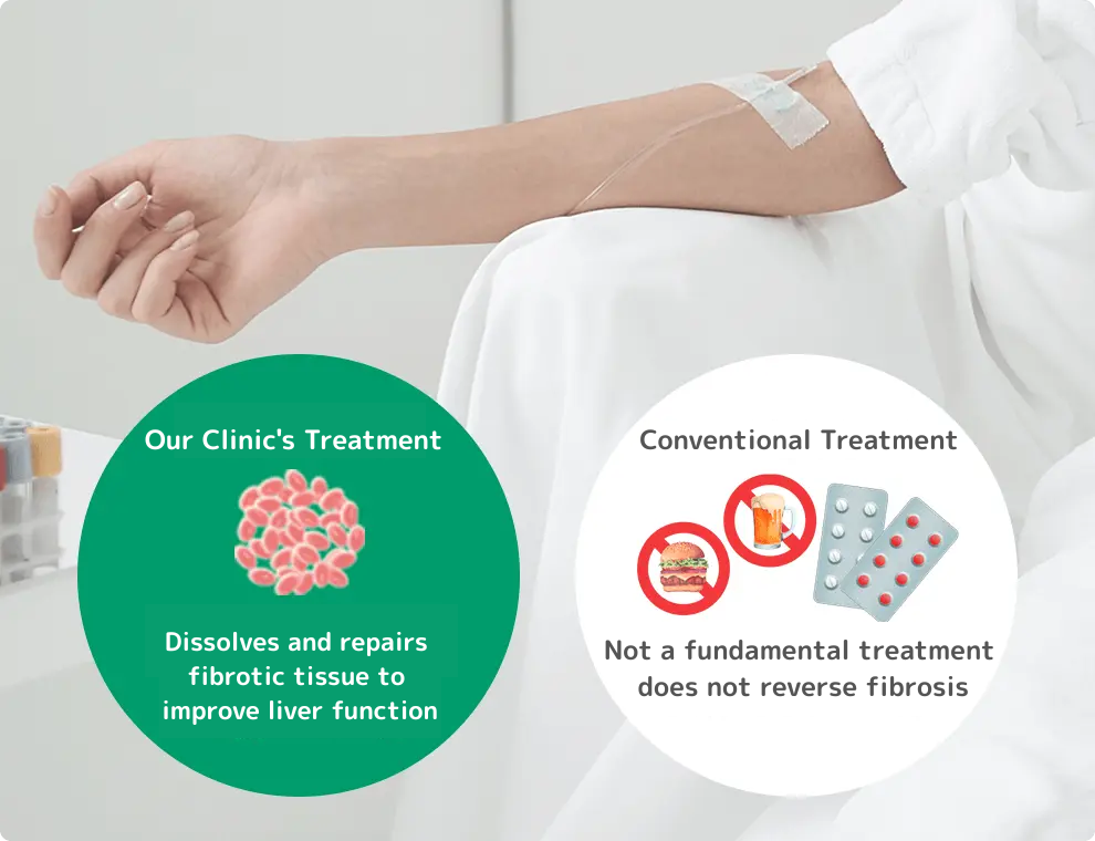 当院の治療:線維化した組織を溶解・修復して肝機能を改善