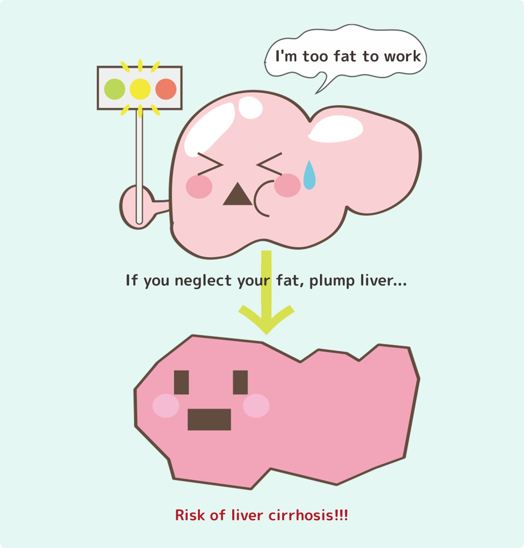 太ってぷりぷりの肝臓くんを放置すると…肝硬変のリスクが!!!