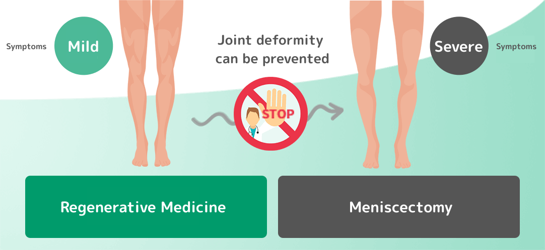 関節の変形を抑えられる