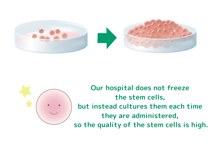当院は、冷凍せずに投与に合わせてその都度培養するため幹細胞の質が高い