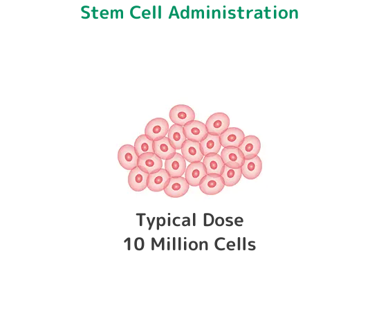 幹細胞投与:一般的な投与数1千万個