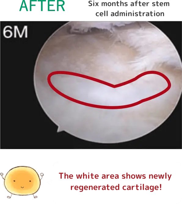 AFTER(幹細胞投与6ヶ月目)細胞くん「白い部分が新しく軟骨が再生されたんだ!」