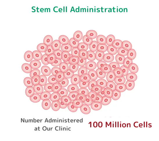 幹細胞投与:一般的な投与数1億個