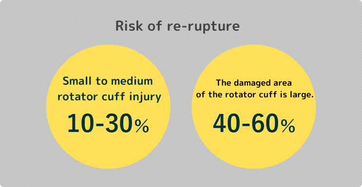 【再断裂のリスク】腱板損傷が小から中：10～30%、腱板損傷部が大：40～60%