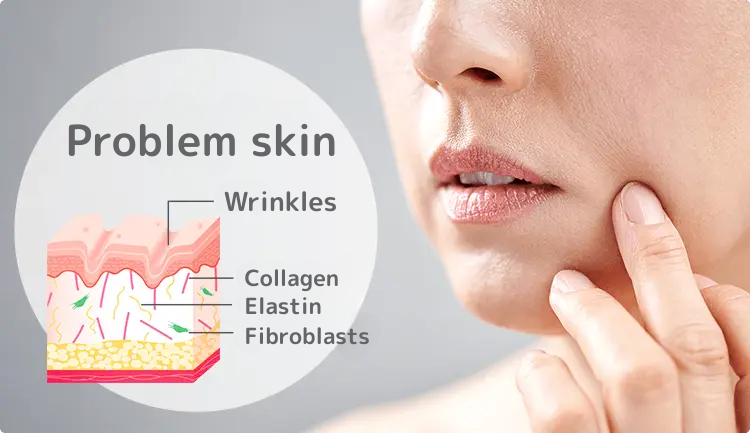 お肌のトラブルや、シワを改善して美肌を目指す