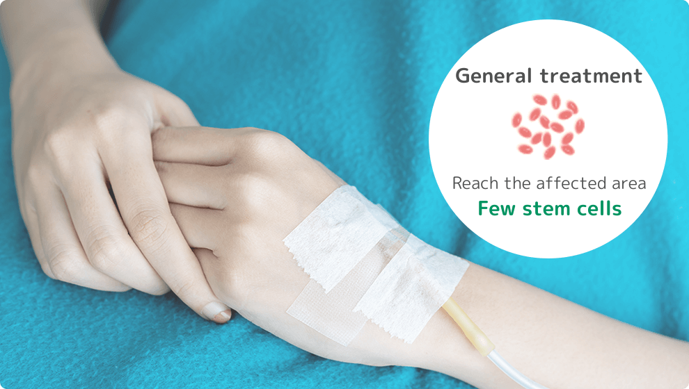 点滴では幹部に届く幹細胞が少なくなる