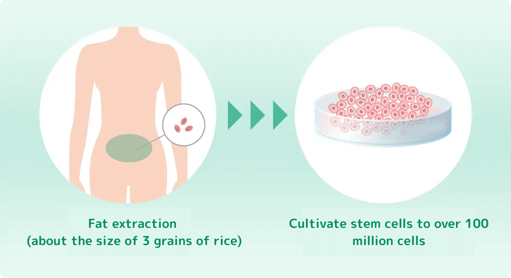 採取する細胞の量が少ない(米粒2~3粒)ため体への負担が少ない
