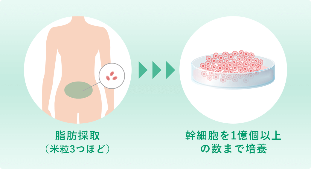 採取する細胞の量が少ない（米粒2～3粒）ため体への負担が少ない