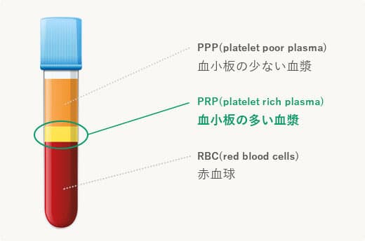 血小板の多い血漿
