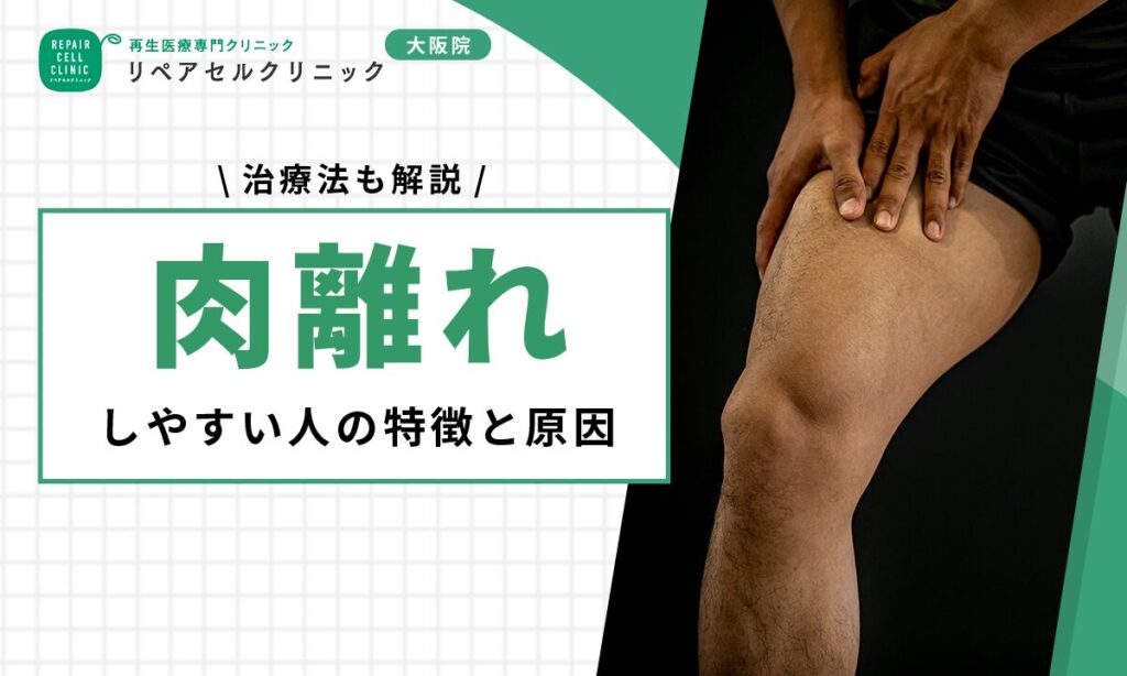 肉離れしやすい人の特徴と原因|治療法も解説