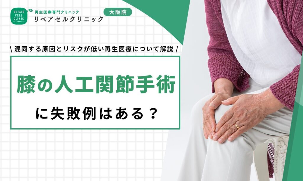 膝の人工関節手術に失敗例はある?混同する原因とリスクが低い再生医療について解説