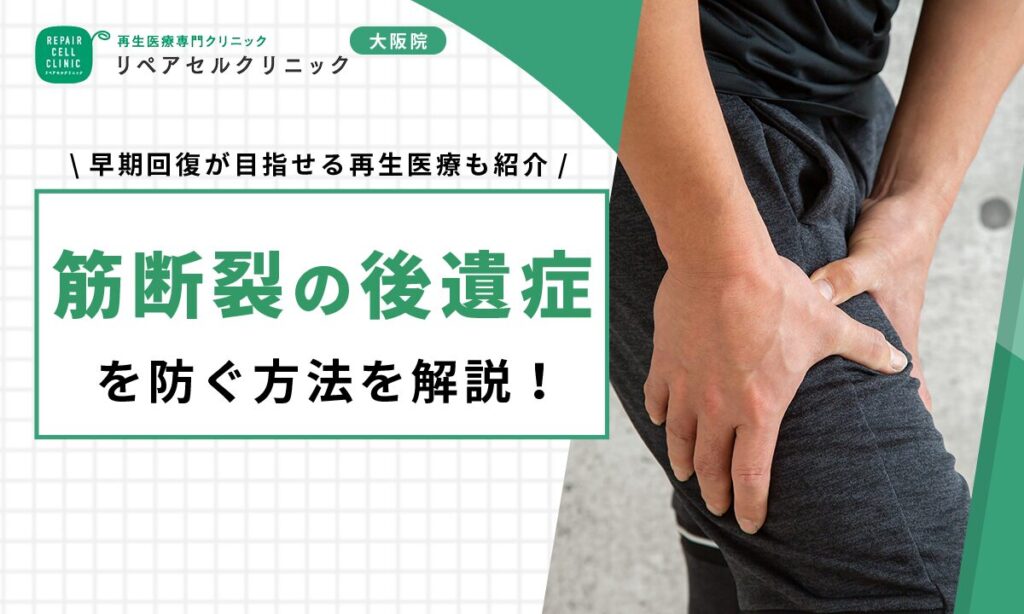 筋断裂の後遺症を防ぐ方法を解説！早期回復が目指せる再生医療も紹介