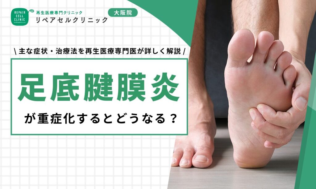 足底腱膜炎が重症化するとどうなる?主な症状・治療法を再生医療専門医が詳しく解説