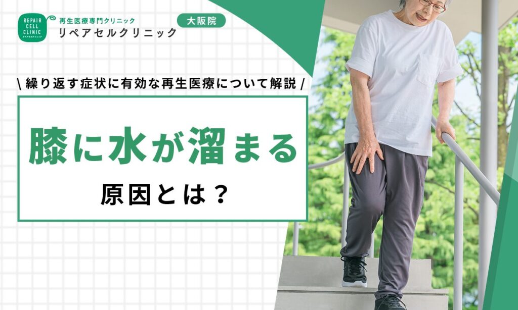 膝に水が溜まる原因とは？繰り返す症状に有効な再生医療について解説