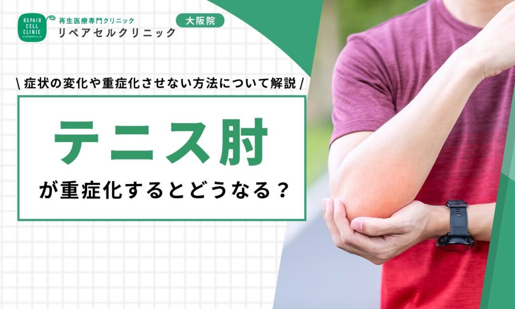テニス肘が重症化するとどうなる?症状の変化や重症化させない方法について解説
