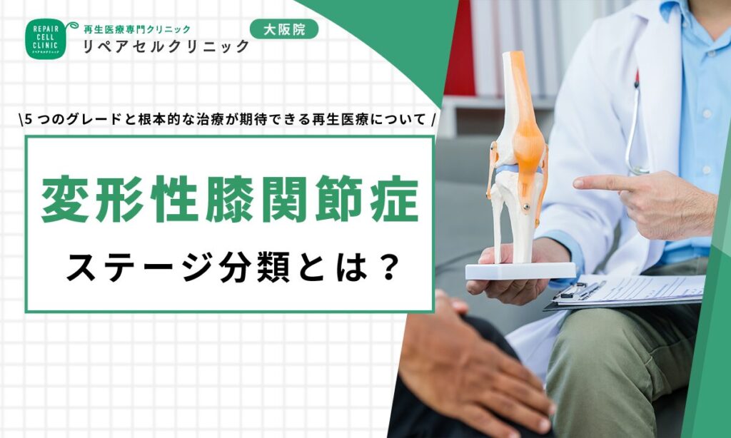 変形性膝関節症ステージ分類とは?5つのグレードと根本的な治療が期待できる再生医療について