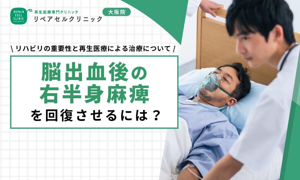 脳出血後の右半身麻痺を回復させるには?リハビリの重要性と再生医療による治療について