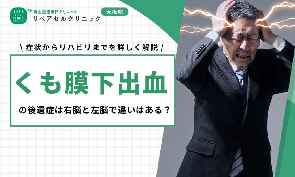 くも膜下出血の後遺症は右脳と左脳で違いはある?症状からリハビリまでを詳しく解説