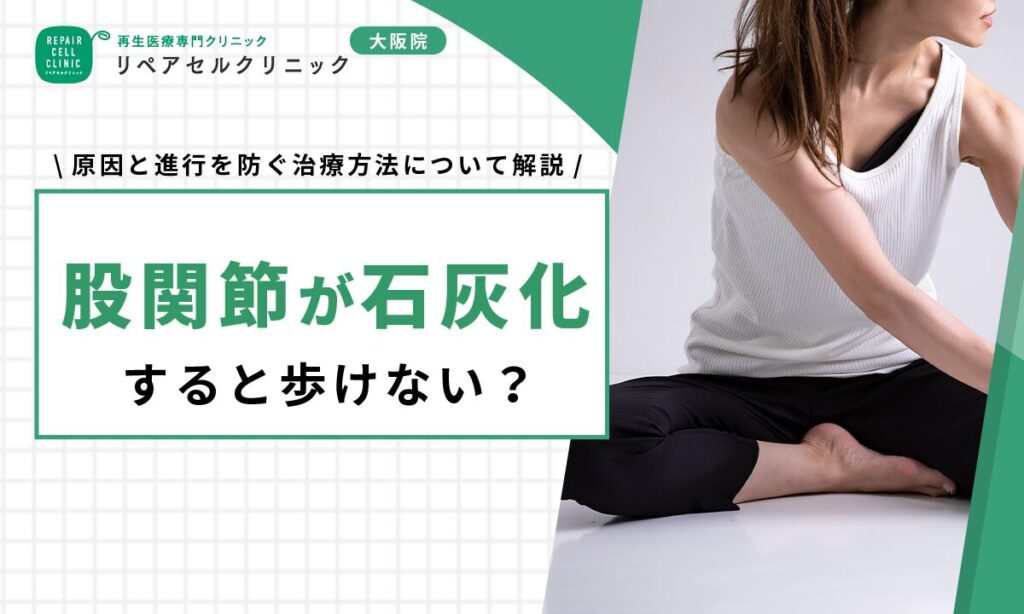 股関節が石灰化すると歩けない?原因と進行を防ぐ治療方法について解説