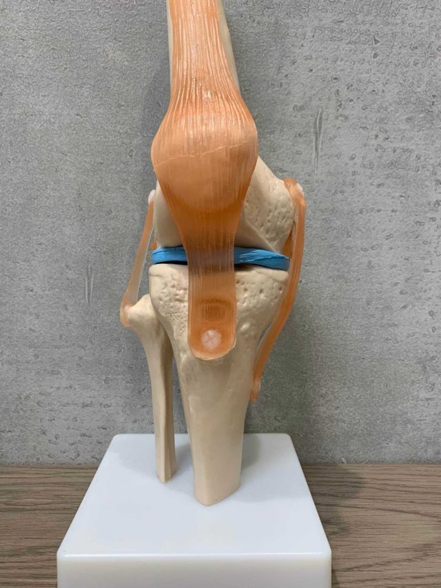 膝関節　骨模型