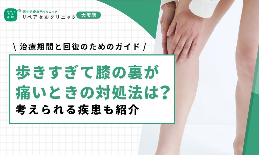歩きすぎて膝の裏が痛いときの対処法は?考えられる疾患も紹介