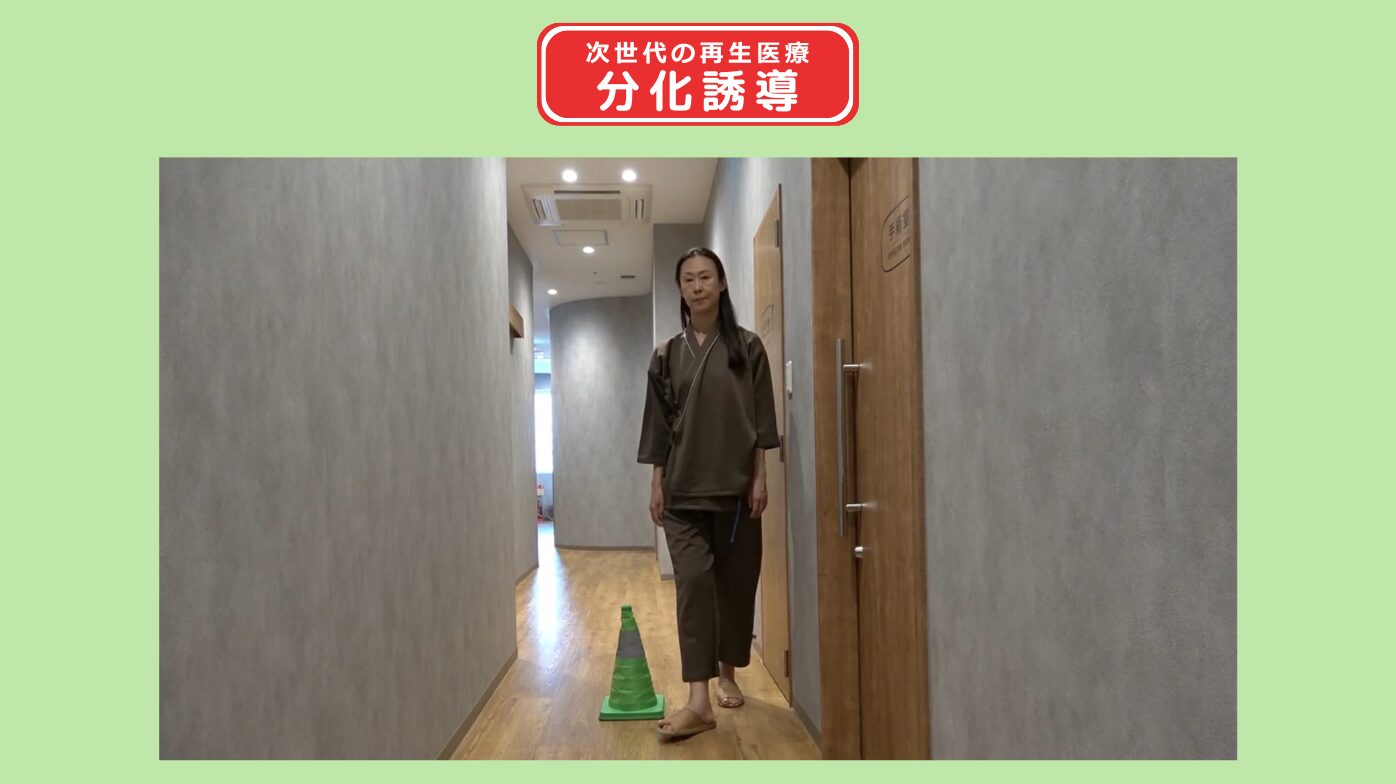 右変形性股関節症 分化誘導