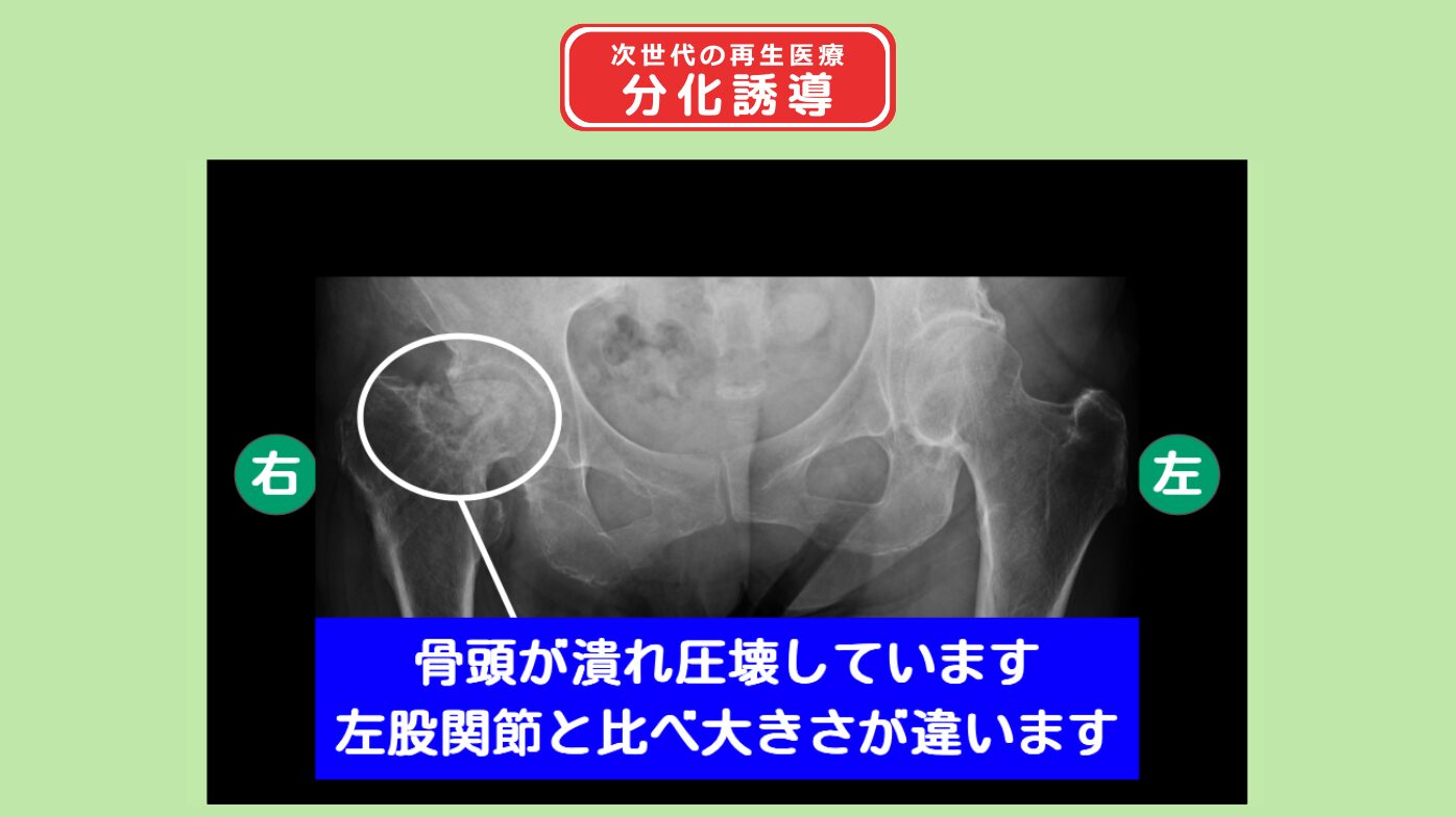 T133301