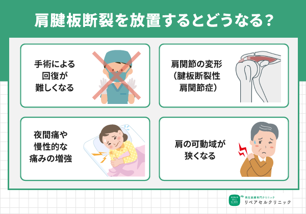 肩腱板断裂は放置すると