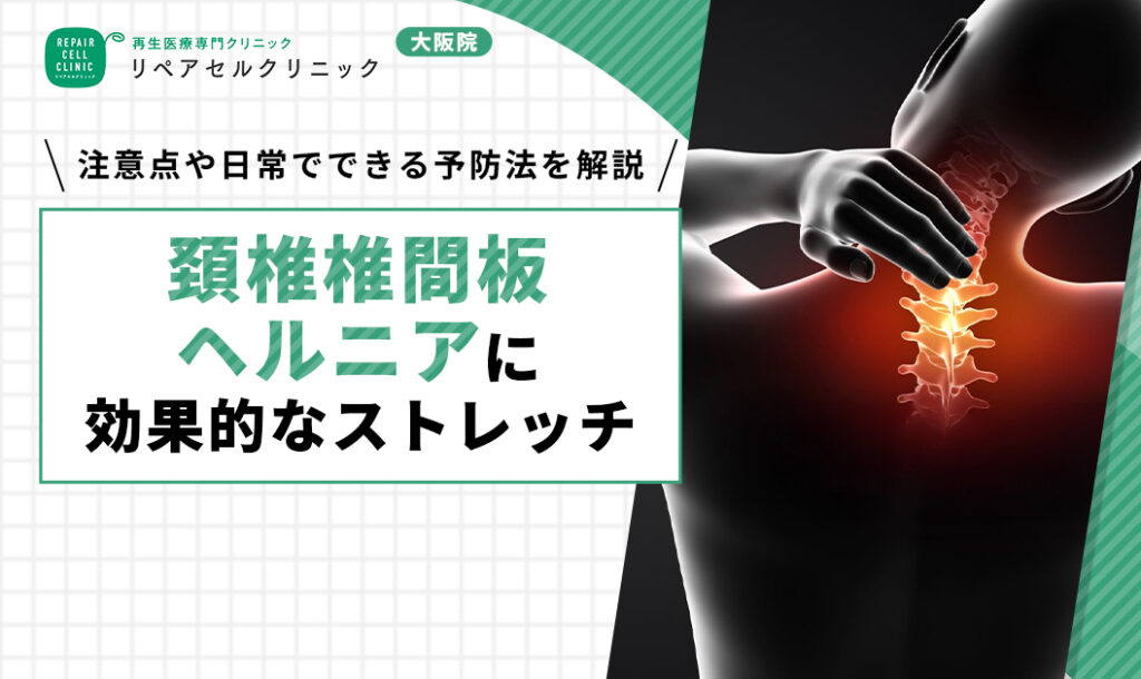 頚椎ヘルニア ストレッチ