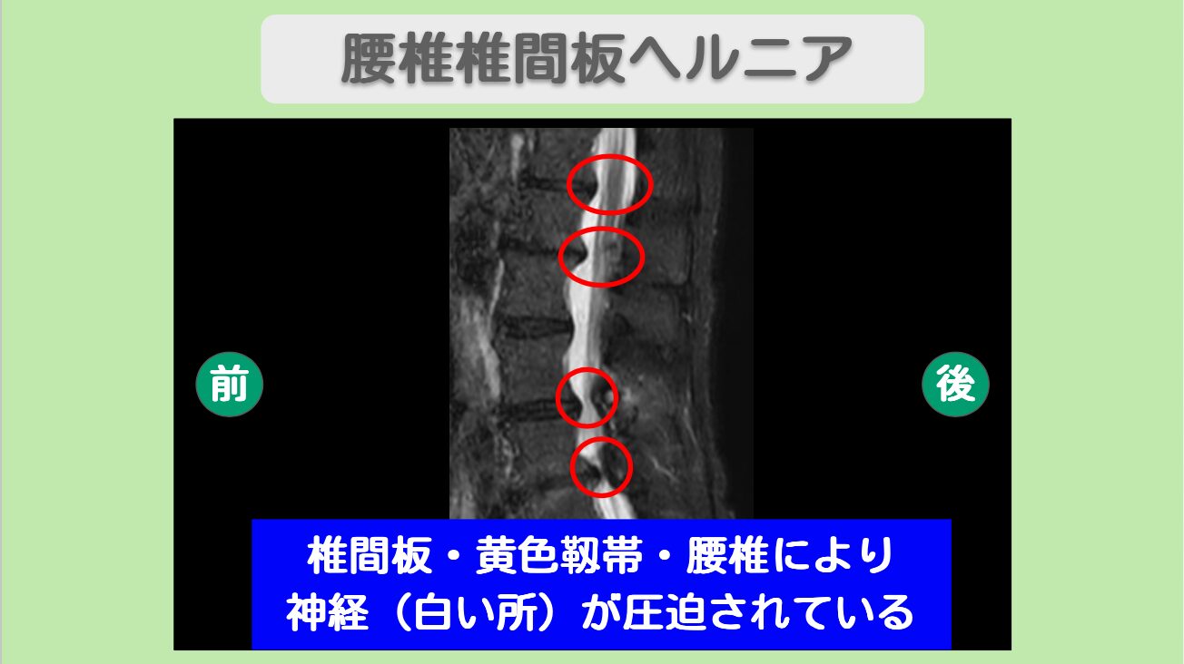 1ad30c4c57ba5071a4cc2c529d2b4481