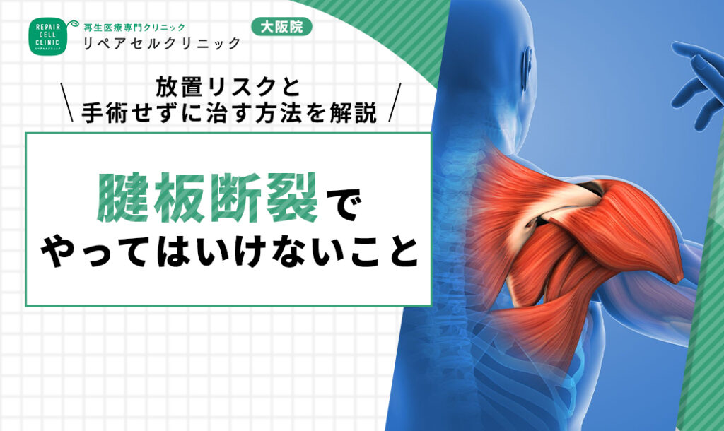 腱板断裂 やってはいけないこと