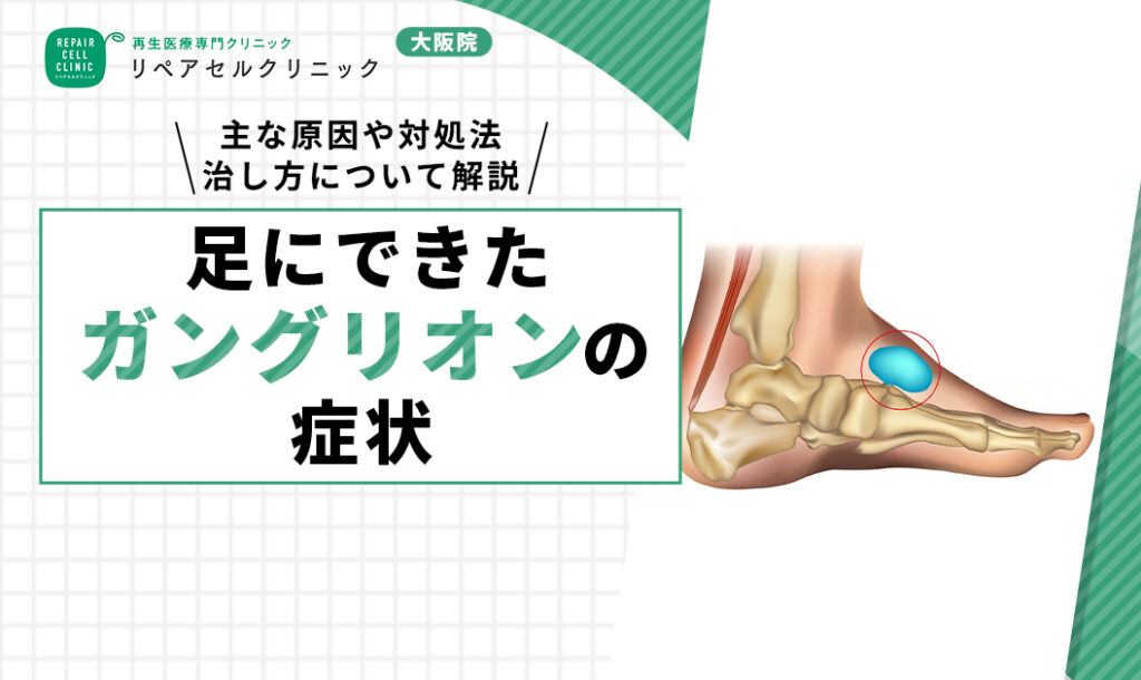 ガングリオン 足