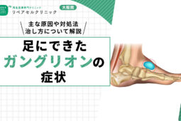 ガングリオン 足