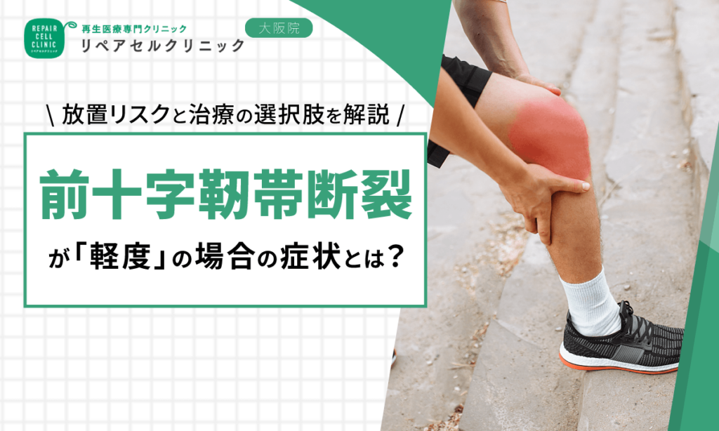 前十字靭帯損傷が「軽度」の場合の症状とは?放置リスクと治療の選択肢を解説